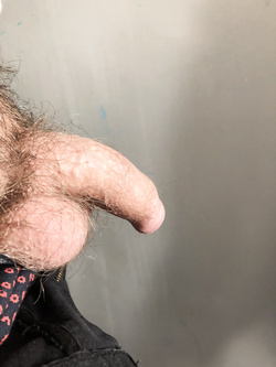 Il mio cazzo da moscio — foto 1/2