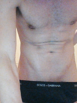 Nudità — foto 1/4