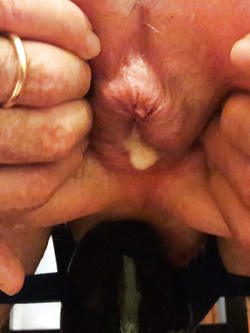 Il mio buco sfondato — foto 2/2