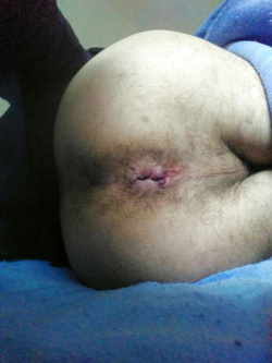 Culetto — foto 3/3