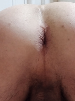Culetto — foto 3/5