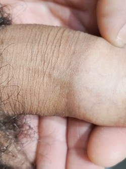 Mio pene piccolo — foto 3/4