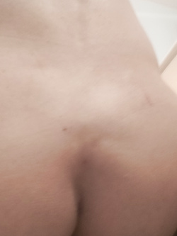 Ci siamo Total body depilazione — foto 5/6